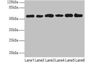 Western blot All lanes: PHF10 antibody at 8 μg/mL Lane 1: Hela whole cell lysate Lane 2: 293T whole cell lysate Lane 3: A2780 whole cell lysate Lane 4: U251 whole cell lysate Lane 5: A549 whole cell lysate Lane 6: A375 whole cell lysate Secondary Goat polyclonal to rabbit IgG at 1/10000 dilution Predicted band size: 57, 56, 52 kDa Observed band size: 57 kDa (PHF1 anticorps  (AA 151-360))