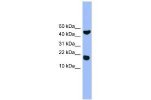 RWDD1 antibody used at 0. (RWDD1 anticorps  (Middle Region))