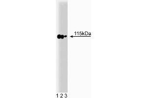 Western blot analysis of p115 on a rat cerebrum lysate. (ARHGAP4 anticorps  (AA 843-955))