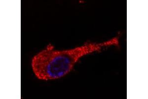 Immunofluorescence staining of neurofilament medium protein in murine Neuro2A cells by antibody conjugated with Dyomics 547 (red). (NEFM anticorps)