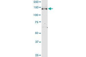 NPHP3 monoclonal antibody (M05), clone 3B1.