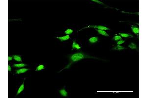 Immunofluorescence of purified MaxPab antibody to RASGRP3 on HeLa cell. (RASGRP3 anticorps  (AA 1-690))