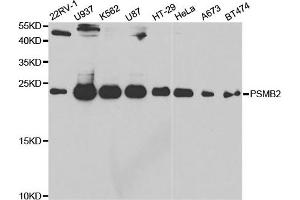 Western Blotting (WB) image for anti-Proteasome (Prosome, Macropain) Subunit, beta Type 2 (PSMB2) antibody (ABIN1876671)