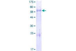 Image no. 1 for Transcriptional Adaptor 1 (TADA1) (AA 1-335) protein (GST tag) (ABIN1322055)