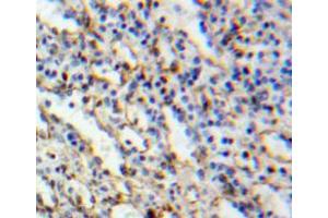 Used in DAB staining on fromalin fixed paraffin-embedded spleen tissue (MYO1G anticorps  (AA 754-1018))