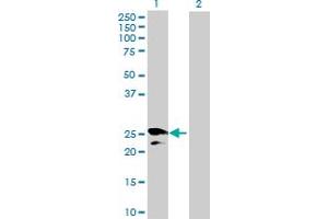Western Blot analysis of HPGD expression in transfected 293T cell line by HPGD MaxPab polyclonal antibody.