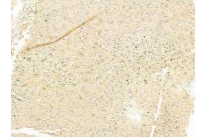 ABIN6262952 and ABIN6277129 at 1/100 staining human normal liver tissue by IHC-P.