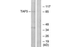 Western blot analysis of extracts from A549 cells, using TAF5 Antibody. (TAF5 anticorps  (AA 381-430))