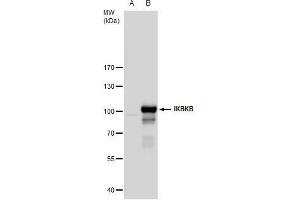 WB Image IKK beta antibody detects IKK beta protein by western blot analysis.