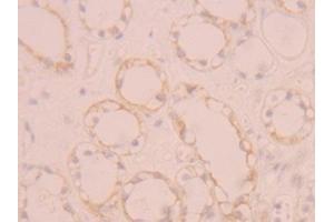 Detection of FGFR1 in Human Kidney Tissue using Polyclonal Antibody to Fibroblast Growth Factor Receptor 1 (FGFR1) (FGFR1 anticorps  (AA 236-362))