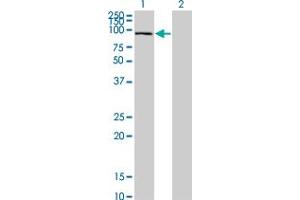 Western Blot analysis of SFMBT1 expression in transfected 293T cell line by SFMBT1 monoclonal antibody (M02), clone 2A1.