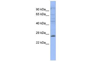 WB Suggested Anti-PLEKHB2  Antibody Titration: 0. (PLEKHB2 anticorps  (Middle Region))