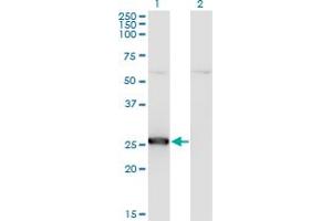 Western Blot analysis of TK1 expression in transfected 293T cell line by TK1 monoclonal antibody (M04), clone 1D10. (TK1 anticorps  (AA 1-234))