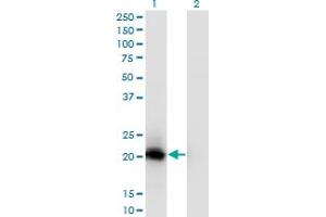 Western Blot analysis of VSTM2L expression in transfected 293T cell line by C20orf102 monoclonal antibody (M02), clone 1A8. (VSTM2L anticorps  (AA 25-204))