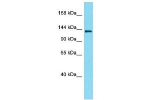 Western Blotting (WB) image for anti-Lemur Tyrosine Kinase 3 (LMTK3) (Middle Region) antibody (ABIN2790811)