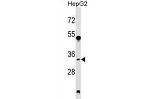 Western Blotting (WB) image for anti-Spermidine Synthase (SRM) antibody (ABIN2999104) (Spermidine Synthase anticorps)