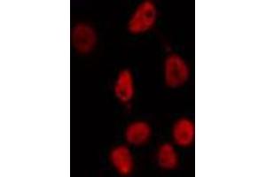 ABIN6274352 staining HepG2 cells by IF/ICC. (E2F2 anticorps  (Internal Region))