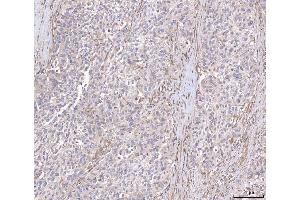 IHC analysis of ANGPT2 using anti-ANGPT2 antibody (ABIN3043725).