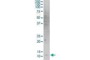 HBXIP monoclonal antibody (M12), clone 4G1. (HBXIP anticorps  (AA 83-173))