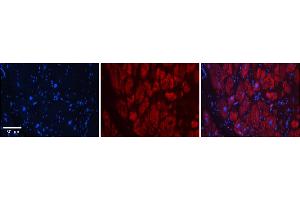 Rabbit Anti-SIX1 Antibody    Formalin Fixed Paraffin Embedded Tissue: Human Adult heart  Observed Staining: Cytoplasmic,Nuclear Primary Antibody Concentration: 1:600 Secondary Antibody: Donkey anti-Rabbit-Cy2/3 Secondary Antibody Concentration: 1:200 Magnification: 20X Exposure Time: 0. (SIX Homeobox 1 anticorps  (Middle Region))