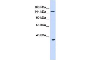 UBE3B antibody used at 1 ug/ml to detect target protein. (UBE3B anticorps  (Middle Region))