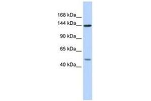 Image no. 1 for anti-Splicing Factor 3b, Subunit 1, 155kDa (SF3B1) (AA 287-336) antibody (ABIN6743003) (SF3B1 anticorps  (AA 287-336))