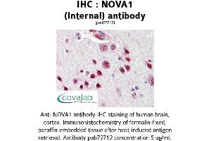 Image no. 1 for anti-Neuro-Oncological Ventral Antigen 1 (NOVA1) (Internal Region) antibody (ABIN1737442) (NOVA1 anticorps  (Internal Region))