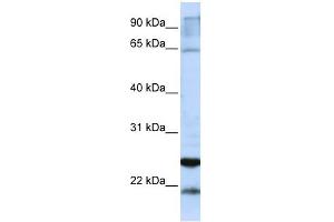 GSTA4 antibody used at 1 ug/ml to detect target protein. (GSTA4 anticorps  (C-Term))