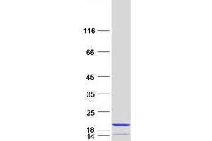 Validation with Western Blot