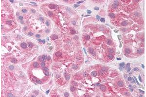 anti-Sirtuin 7 (SIRT7) (AA 317-366) antibody