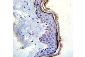 c-Kit antibody immunohistochemistry analysis in formalin fixed and paraffin embedded human skin tissue.