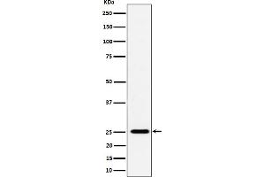Western blot analysis of CFD expression in THP-1 cell lysate.
