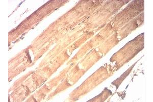 Immunohistochemical analysis of paraffin-embedded muscle tissues using CKM mouse mAb with DAB staining.