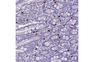 Immunohistochemical staining of human duodenum with IL17REL polyclonal antibody  shows selective positivity in a subset of leukocytes at 1:50-1:200 dilution. (IL17REL anticorps)