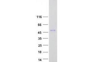 Validation with Western Blot