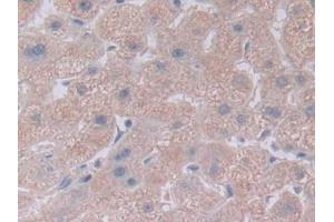 Detection of NOTCH4 in Human Liver Tissue using Polyclonal Antibody to Notch Homolog 4 (NOTCH4) (NOTCH4 anticorps  (AA 1715-2001))