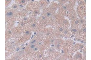 Detection of NOTCH4 in Human Liver Tissue using Polyclonal Antibody to Notch Homolog 4 (NOTCH4)