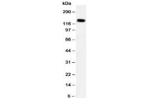 Western blot testing of PTCH2 antibody and HeLa cell lysate. (Patched 2 anticorps  (C-Term))