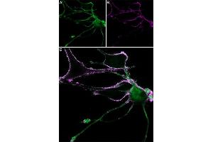 Neurite outgrowth was induced in  cells through 8 days exposure to 100 ng/mL Native mouse NGF 2.