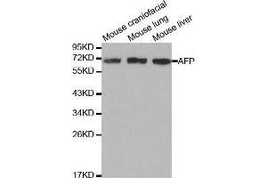 Western blot analysis of extracts of various cell lines, using AFP antibody.