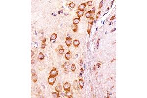 Immunohistochemical analysis of paraffin-embedded R.