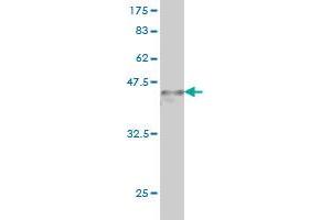 Western Blot detection against Immunogen (36. (ARID1B anticorps  (AA 1364-1460))