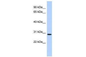 SERTAD2 antibody used at 0. (SERTAD2 anticorps  (N-Term))