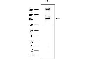 Western blot analysis of lysates from HUVEC cells, using DNMT3B Mouse Monoclonal Antibody at 1/1000 dilution.