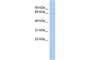 WB Suggested Anti-TIGD1 Antibody Titration: 0. (TIGD1 anticorps  (Middle Region))