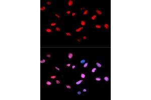 Immunofluorescence analysis of U2OS cells using Phospho-Rb-S811 antibody (ABIN5969933). (Retinoblastoma 1 anticorps  (pSer811))