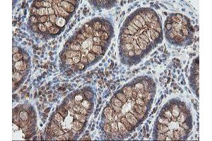 Image no. 5 for anti-Ubiquitin-Conjugating Enzyme E2G 2 (UBE2G2) antibody (ABIN1501630)