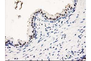 Immunohistochemical staining of paraffin-embedded Human prostate tissue using anti-SMS mouse monoclonal antibody. (SMS anticorps)