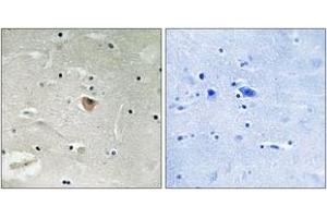 Immunohistochemistry analysis of paraffin-embedded human brain, using KIF13B Antibody. (KIF13B anticorps  (AA 111-160))