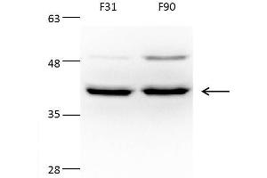 WB Image Sample(30 μg of whole cell lysate) A:293T B:A431, C:MOLT4, 10% SDS PAGE antibody diluted at 1:500